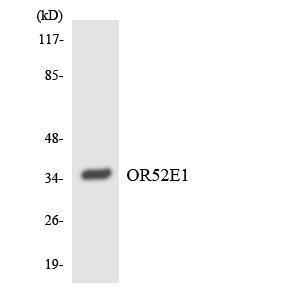 Anti-OR52E1 Rabbit Polyclonal Antibody