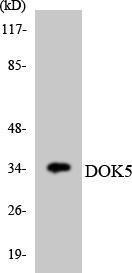 Western blot analysis of the lysates from HT 29 cells using Anti-DOK5 Antibody