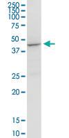 Anti-ACADM Rabbit Polyclonal Antibody