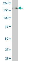 Anti-USP31 Mouse Monoclonal Antibody [clone: 3B6]