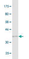 Anti-PARP1 Mouse Monoclonal Antibody [clone: 2C7]