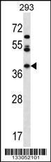 Anti-MIOX Rabbit Polyclonal Antibody (AP (Alkaline Phosphatase))