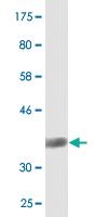 Anti-SIAH1 Mouse Monoclonal Antibody [clone: 2C5]