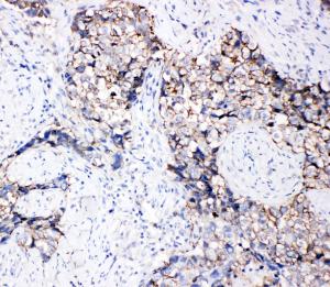 Anti-Eph Receptor B3 Rabbit Polyclonal Antibody