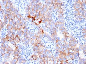 Anti-HER2 Mouse Monoclonal Antibody [clone: ERBB2/3080]