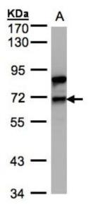 Anti-ROBO4 Rabbit Polyclonal Antibody