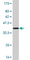 Anti-TLK1 Mouse Monoclonal Antibody [clone: 4B3]