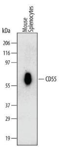 Anti-CD55 Rat Monoclonal Antibody [clone: 11D35]