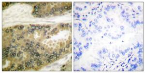 Anti-Cyclin D3 Rabbit Polyclonal Antibody