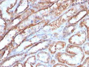 Immunohistochemical analysis of formalin-fixed, paraffin-embedded human renal cell carcinoma using Anti-Mitochondria Antibody [MTC719]