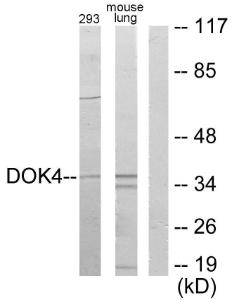 Western blot analysis of lysates from 293 and mouse lung using Anti-DOK4 Antibody. The right hand lane represents a negative control, where the antibody is blocked by the immunising peptide.