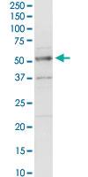 Anti-ACADM Rabbit Polyclonal Antibody