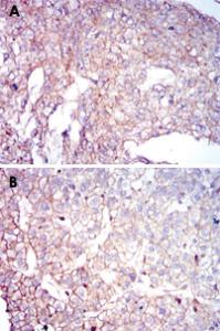 Anti-COTL1 Mouse Monoclonal Antibody [clone: 5C8]