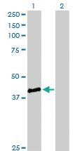 Anti-STBD1 Rabbit Polyclonal Antibody