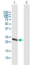 Anti-ZCCHC4 Mouse Polyclonal Antibody