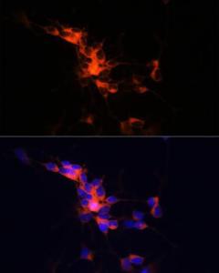 Immunofluorescence analysis of SH-SY5Y cells using Anti-beta III Tubulin Antibody [ARC0456] (A309019) at a dilution of 1:100 (40x lens) DAPI was used to stain the cell nuclei (blue)