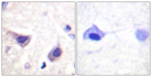 Immunohistochemical analysis of paraffin-embedded human brain tissue using Anti-JAK3 Antibody The right hand panel represents a negative control, where the antibody was pre-incubated with the immunising peptide