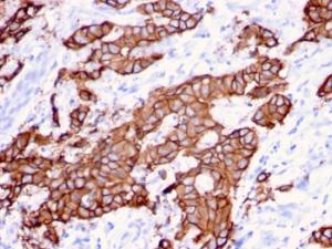 Anti-HER2 Mouse Monoclonal Antibody [clone: ERBB2/3080]