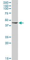 Anti-ACADM Rabbit Polyclonal Antibody