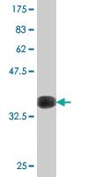 Anti-HNF1B Mouse Monoclonal Antibody [clone: 3A9]