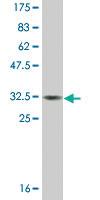 Anti-MT3 Mouse Monoclonal Antibody [clone: 3E8]