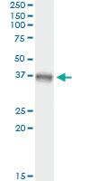 Anti-MAP2K3 Mouse Monoclonal Antibody