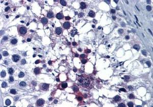 Anti-Thioredoxin Domain Containing 4 Mouse Monoclonal Antibody [clone: 3C7]