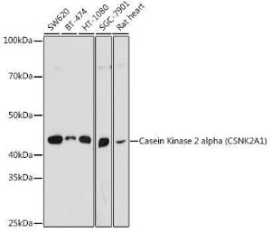 Western blot analysis of extracts of various cell lines, using Anti-CSNK2A1 Antibody (A307777) at 1:1,000 dilution. The secondary antibody was Goat Anti-Rabbit IgG H&L Antibody (HRP) at 1:10,000 dilution.