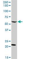 Anti-CAMK2B Rabbit Polyclonal Antibody