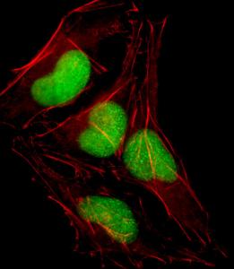 Anti-SOX18 Rabbit Polyclonal Antibody