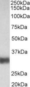 Antibody anti-SFTPA1 100 µg