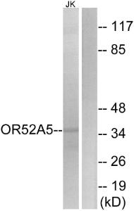 Western blot analysis of lysates from Jurkat cells using Anti-OR52A5 Antibody. The right hand lane represents a negative control, where the antibody is blocked by the immunising peptide