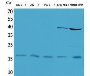 Western blot analysis of ES U87, PC 3, SHSY5Y, mouse liver cells using Anti-IL1B Antibody