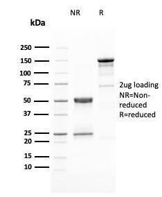 Anti-HER2 Mouse Monoclonal Antibody [clone: ERBB2/3080]