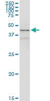 Anti-ACADM Rabbit Polyclonal Antibody