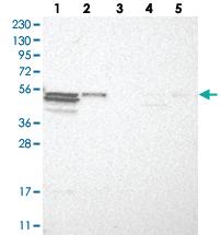 Anti-TRIM11 Rabbit Polyclonal Antibody