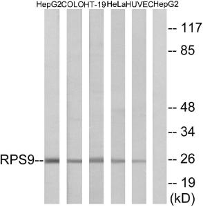 Western blot analysis of lysates from HepG COLO, HT-29, HeLa, and HUVEC cells using Anti-RPS9 Antibody. The right hand lane represents a negative control, where the antibody is blocked by the immunising peptide.