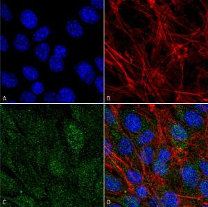 Anti-VPS34 Rabbit Polyclonal Antibody