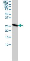 Anti-PSMA7 Mouse Monoclonal Antibody [clone: 1A10-3G12]