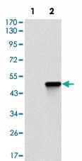 Anti-COTL1 Mouse Monoclonal Antibody [clone: 5C8]