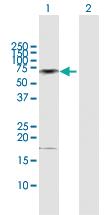 Anti-CAMK2B Rabbit Polyclonal Antibody