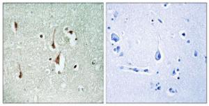 Immunohistochemical analysis of paraffin-embedded human brain tissue using Anti-Cyclin D1 Antibody. The right hand panel represents a negative control, where the antibody was pre-incubated with the immunising peptide.