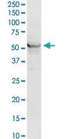 Anti-ACADM Rabbit Polyclonal Antibody