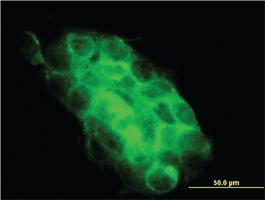 Anti-USP31 Mouse Monoclonal Antibody [clone: 3B6]