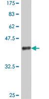 Anti-PARP4 Mouse Polyclonal Antibody