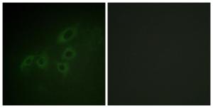 Immunofluorescence analysis of A549 cells using Anti-JAK3 Antibody The right hand panel represents a negative control, where the antibody was pre-incubated with the immunising peptide