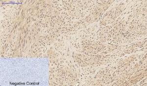 Immunohistochemical analysis of paraffin-embedded human uterus tissue using Anti-IL1B Antibody at 1:200 (4°C overnight). Negative control was secondary antibody only.