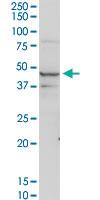 Anti-ACADM Rabbit Polyclonal Antibody