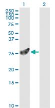 Anti-PSMA7 Mouse Monoclonal Antibody [clone: 1A10-3G12]