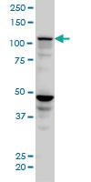 Anti-SEC24D Mouse Monoclonal Antibody [clone: 1A8]